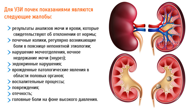 УЗИ почек